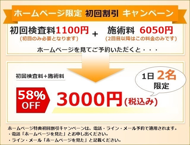 関西 関東限定 取付サービス品 自動車パーツ 送料無料 カー用品 ルーフスポイラー 車パーツ ハッチスポイラー ノブレッセ Cr Z ルーフ スポイラー 純正各色 塗装済品 カラー ストームシルバーメタリック Nh642m Partsisland お車の持込可能な方限定 ルーフ